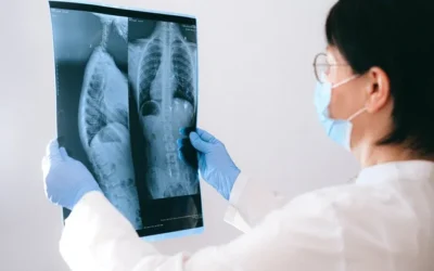 Americana é diagnosticada com câncer de pulmão e curada no mesmo dia