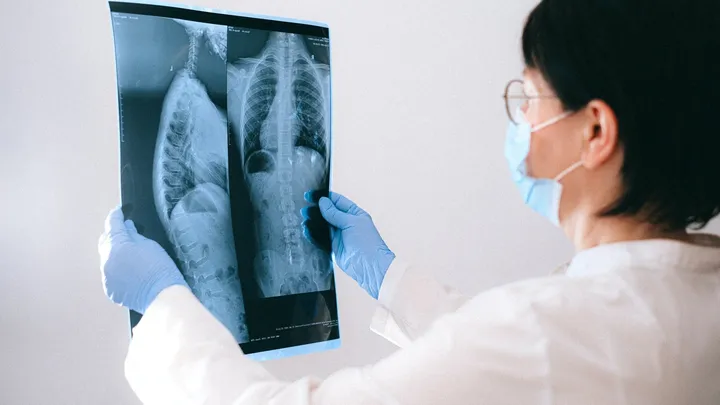 Americana é diagnosticada com câncer de pulmão e curada no mesmo dia