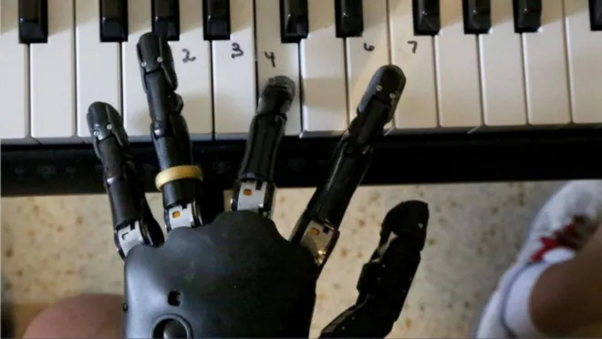 Startup cria “1º braço humano artificial” do mundo
